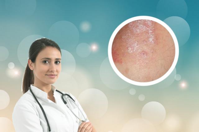 湿疹和皮肤癣哪个更难治愈