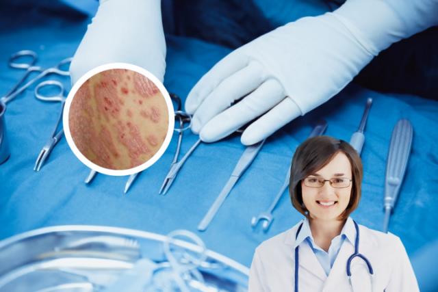 干性湿疹与银屑病的区别