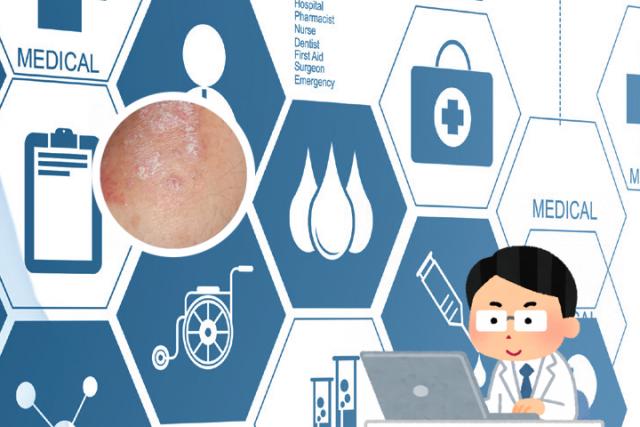 皮肤ct能区分湿疹和银屑病吗