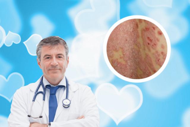 100种皮肤病对照表湿疹图片