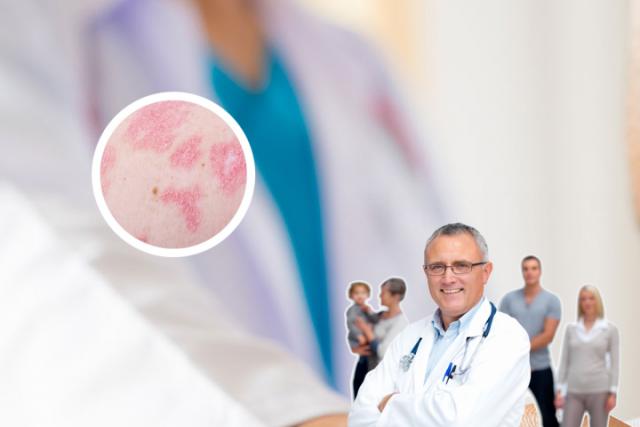 湿疹和牛皮癣哪个严重